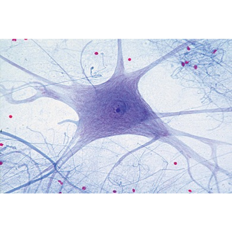 Mikropräparat: Motorische Nervenzellen 