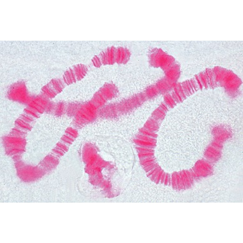 Mikropräparat: Riesenchromosomen aus der Speicheldrüse