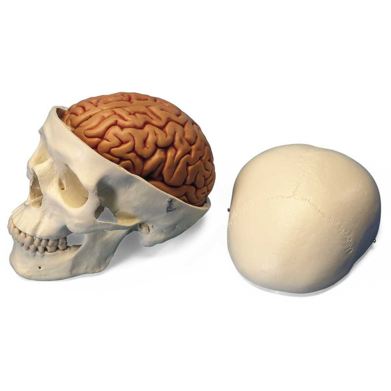 Klassik-Schädel mit Gehirn