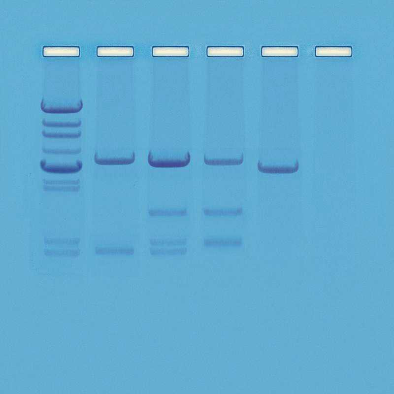 Kit zur Vaterschaftsanalyse (PCR)