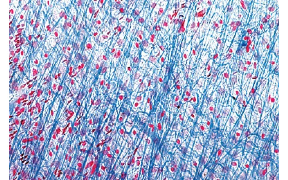 Mikropräparat: Fibrilläres netzförmiges Bindegewebe vom Säugetier