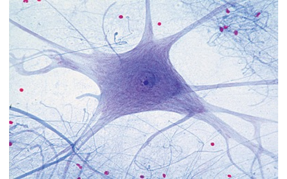 Mikropräparat: Motorische Nervenzellen 