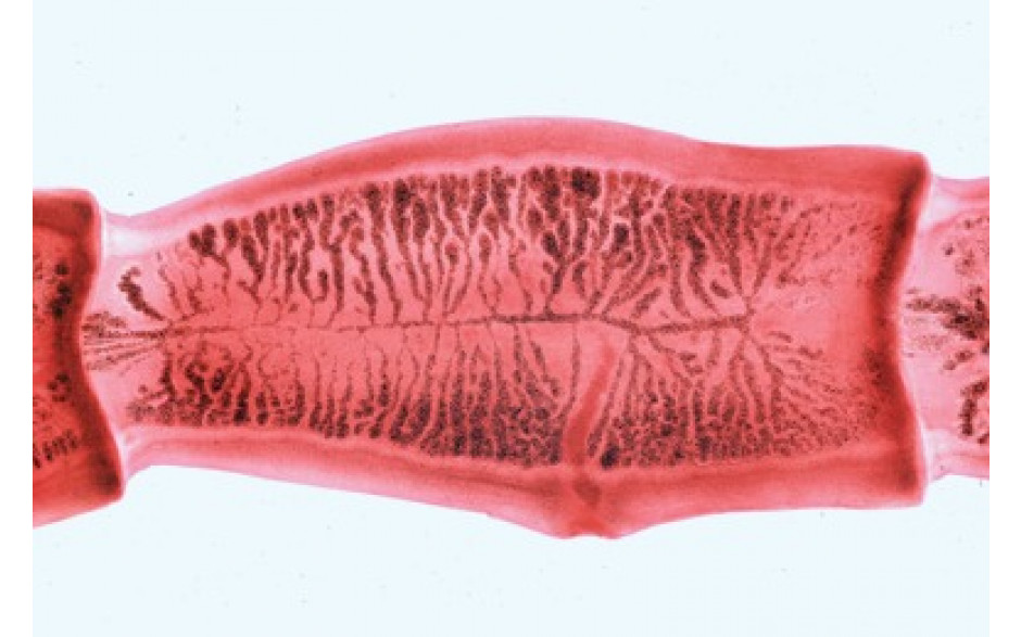 Mikropräparat: Bandwurm