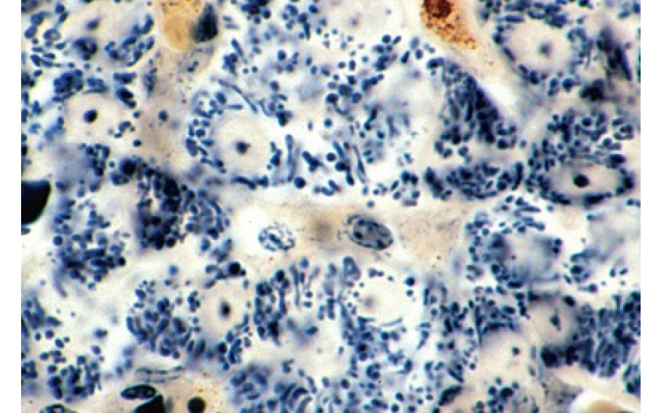 Mikropräparat: Mitochondrien in den Zellen von Leber oder Niere