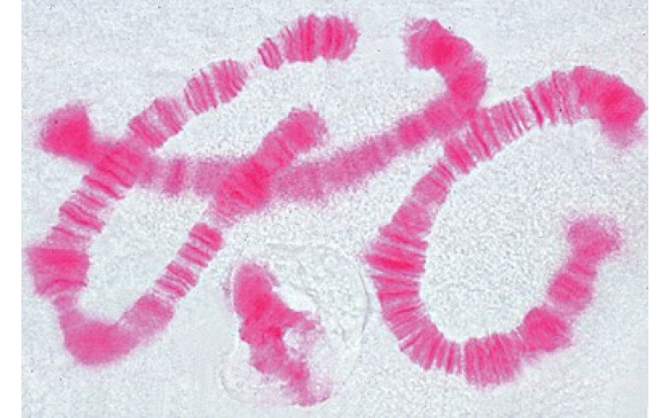 Mikropräparat: Riesenchromosomen aus der Speicheldrüse