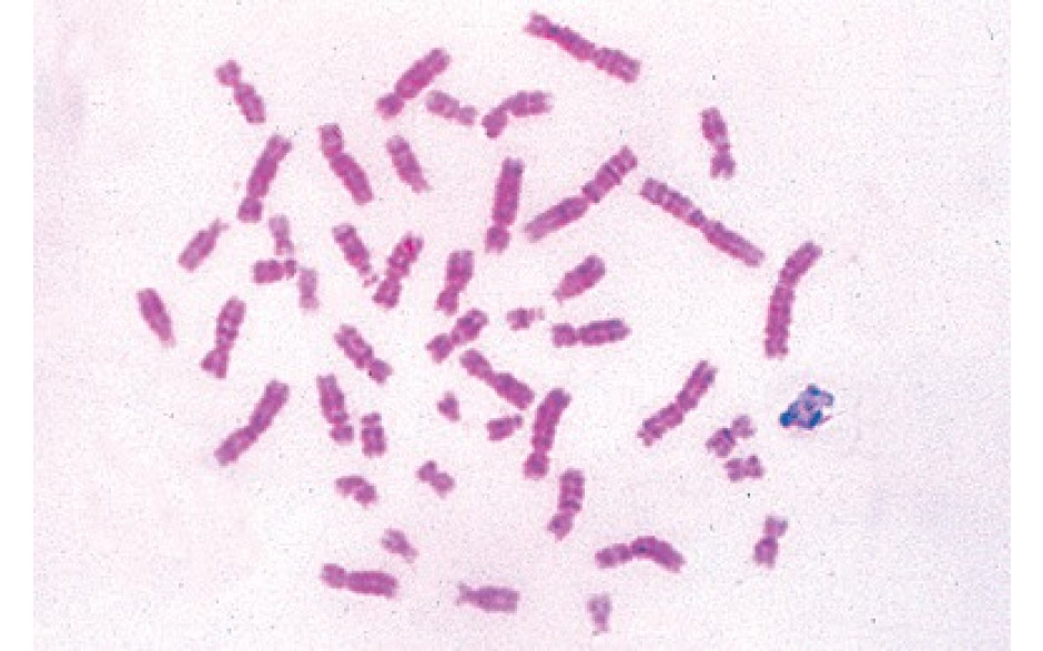 Mikropräparat: Chromosomen des Menschen im Metaphasestadium