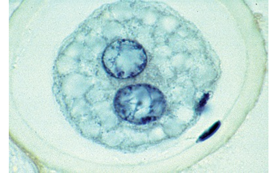 Mikropräparat: Reifeteilung in den Eiern vom Pferdespulwurm