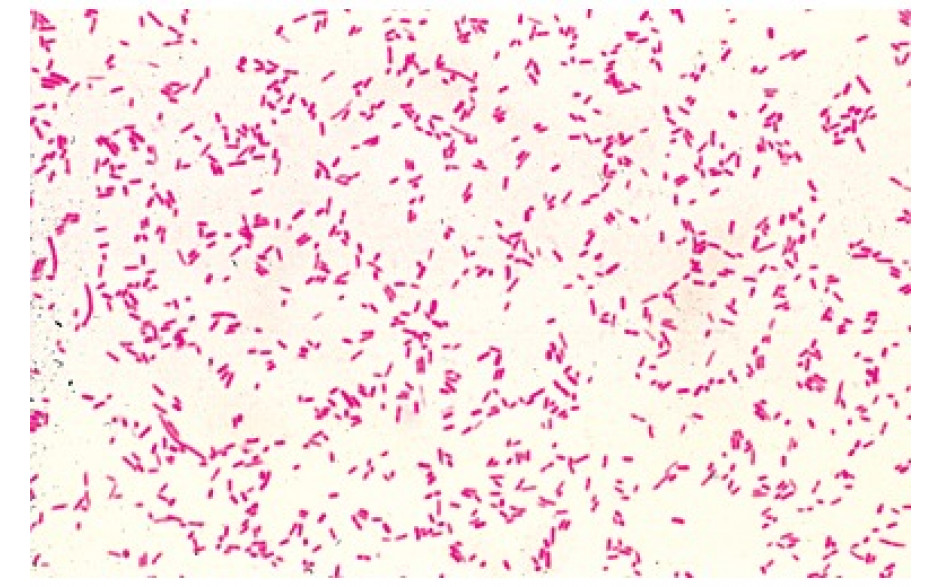 Mikropräparat: Typhusbakterien