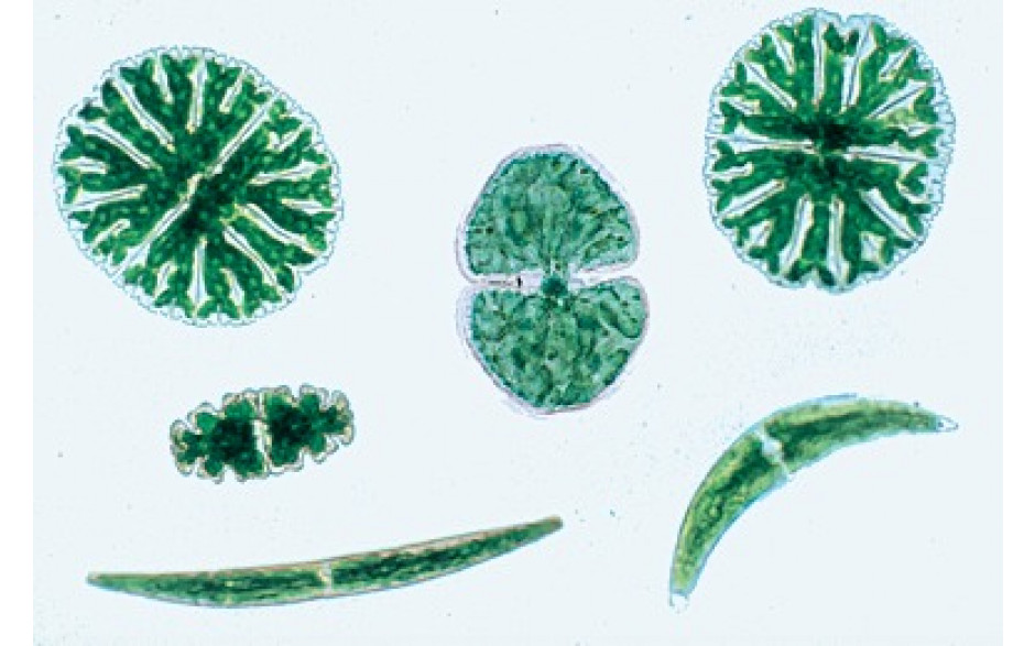 Mikropräparat: Zieralgen