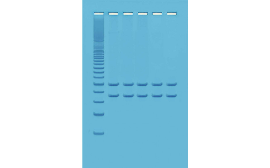 Mitochondrien-DNA-Analyse mit PCR