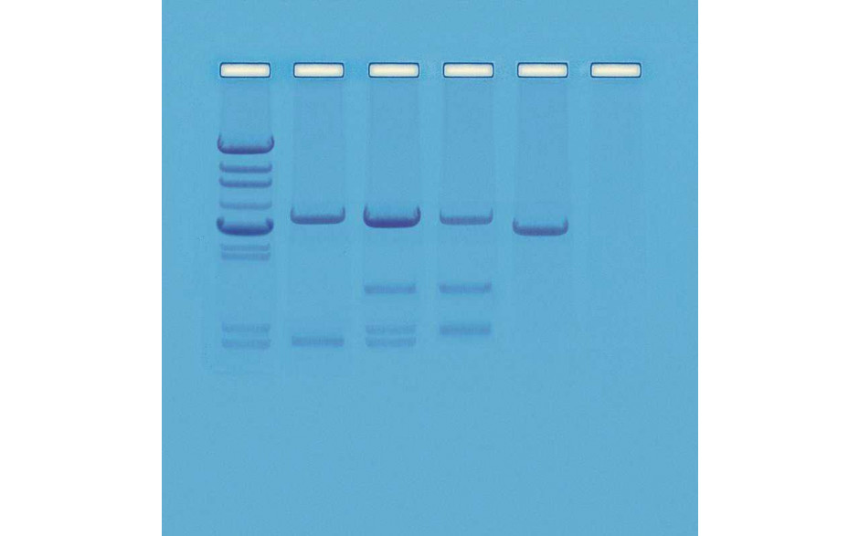 Kit zur Vaterschaftsanalyse (PCR)